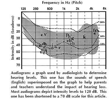 Audiogram with Sounds of Speech