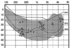 Audiogram: a graph used by audiologists to determine hearing levels. This one has the sounds of speech (English) superimposed on the graph to help parents and teachers understand the impact of hearing loss. Most audiograms depict intensity levels to 120